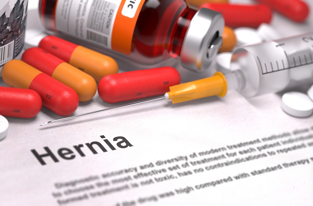 Is Your Hernia A Silent Danger?