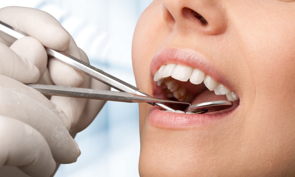 The Importance of Dental Care during Cancer Treatment