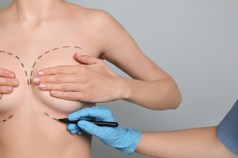 Dr. Michael Decherd- Silicone versus Saline Breast Implants
