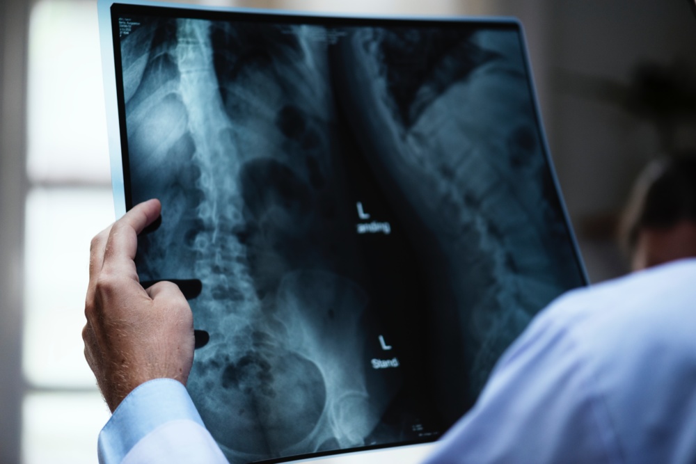 What is Revision Spine Surgery?