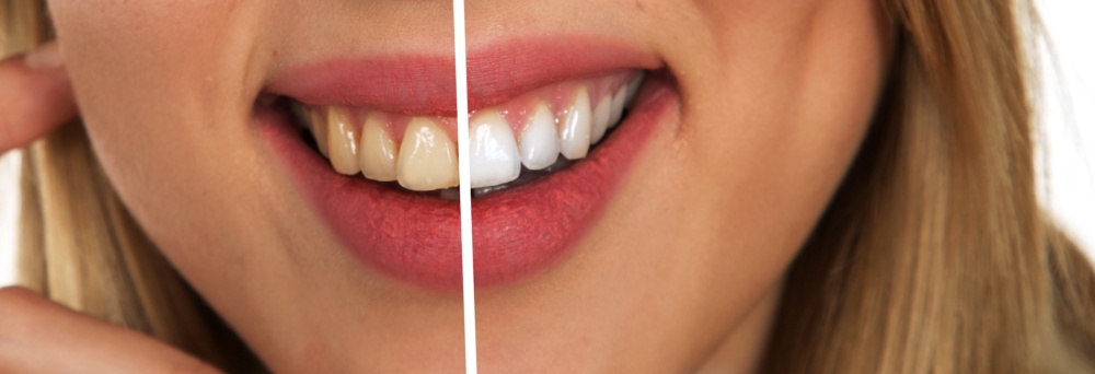YES, Flossing Is Necessary for Proper Dental Care (Here Are the Reasons Why)