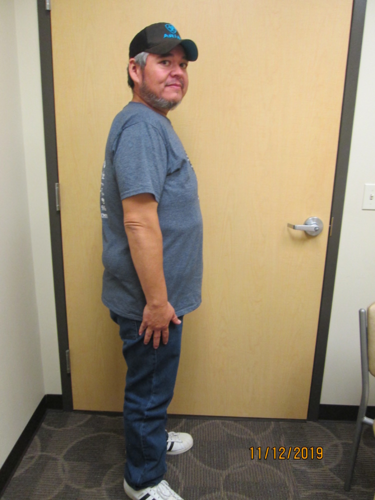 DHR Weightloss - Patient Testimonial