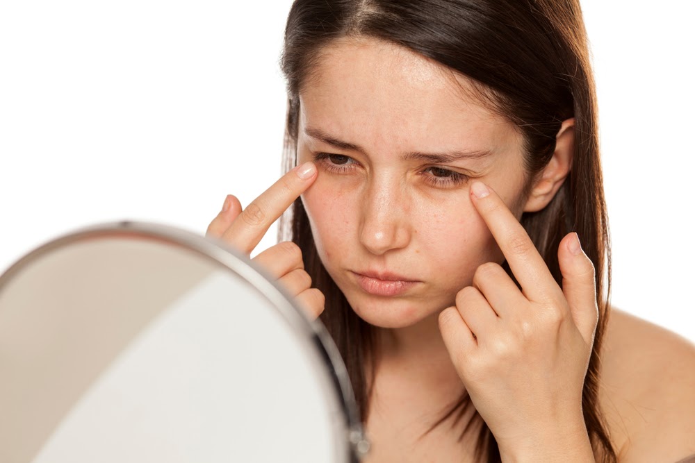 6 EFFECTIVE WAYS TO CURE DARK CIRCLES