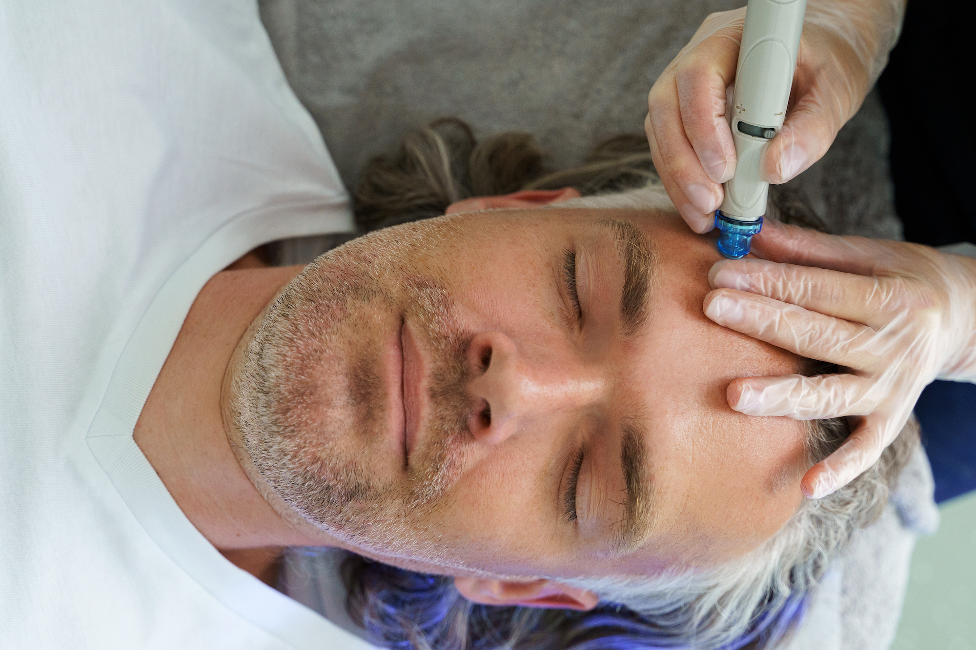 What Is A Hydrafacial?